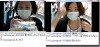 BBA before after.png
